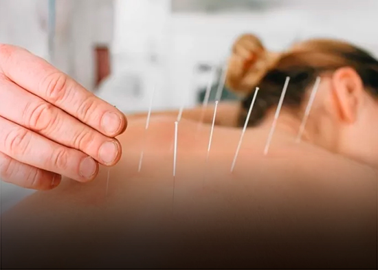 Acupuntura es mucho más que agujas, un camino hacia bienestar emocional