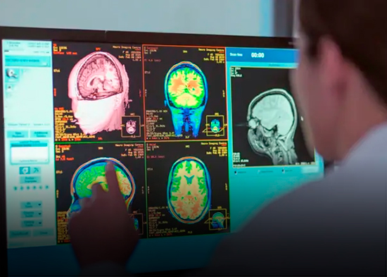 La adolescencia se alarga hasta los 30, según la neurociencia