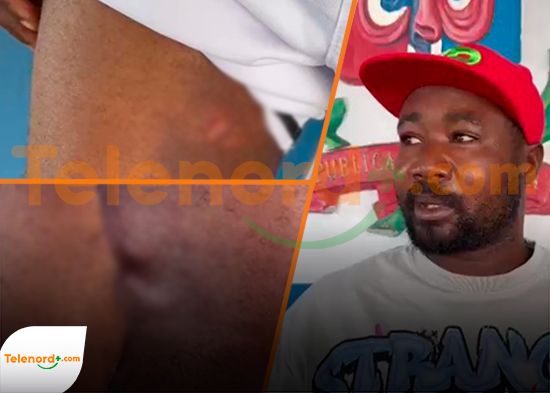  Hieren de bala a un hombre y lo despojan de 50 mil pesos en comunidad San Felipe de Pimentel